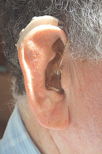Contra el estigma de perder audición